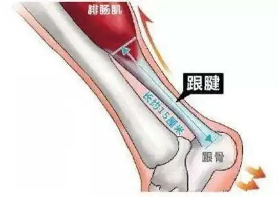 跟腱是什么结构形成的,跟腱是由什么组成的(就像武林高手被"挑脚筋"废