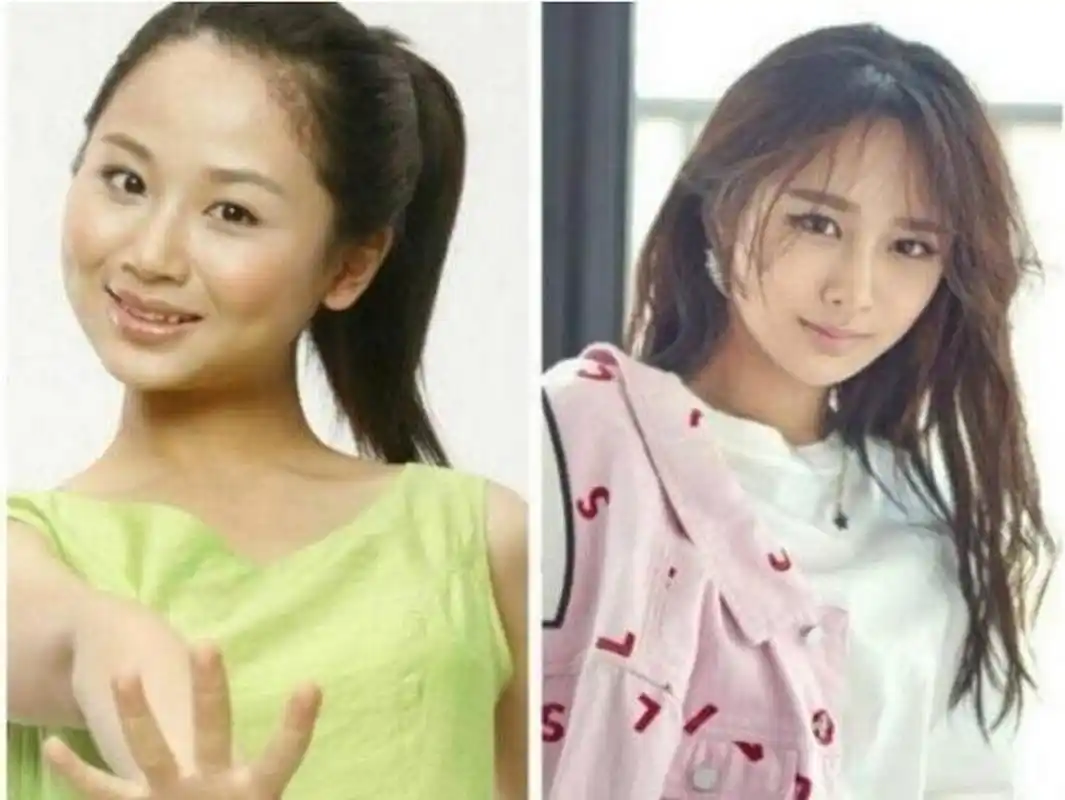 那些否认整容的女明星中,angelababy,杨幂和杨紫都被质疑过整容,邓