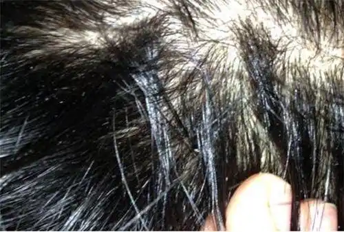 头发上很多细碎头皮屑,白泥,用手挠就能挠下来.