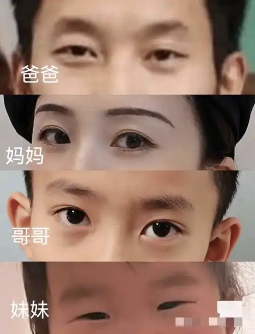 基因_双眼皮_遗传