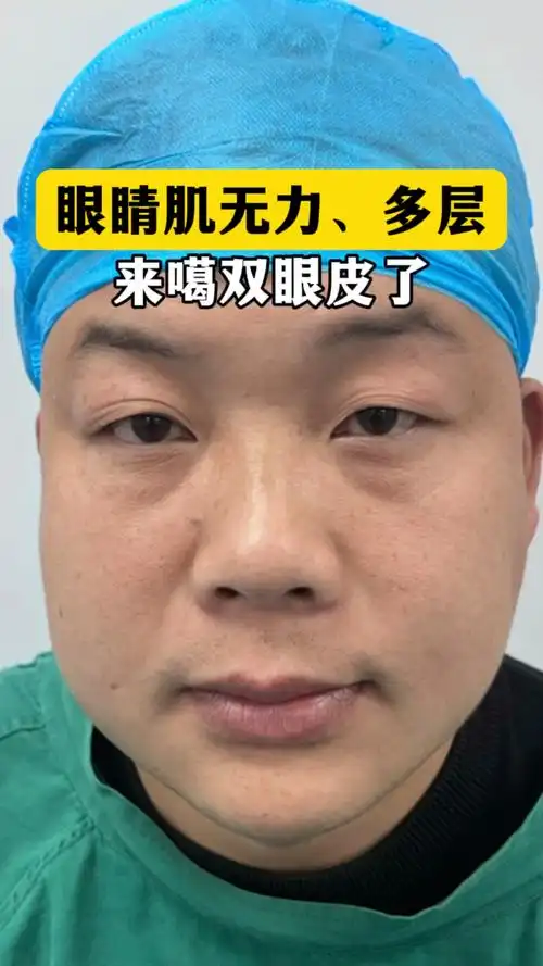 眼睛肌无力多层 来噶双眼皮了