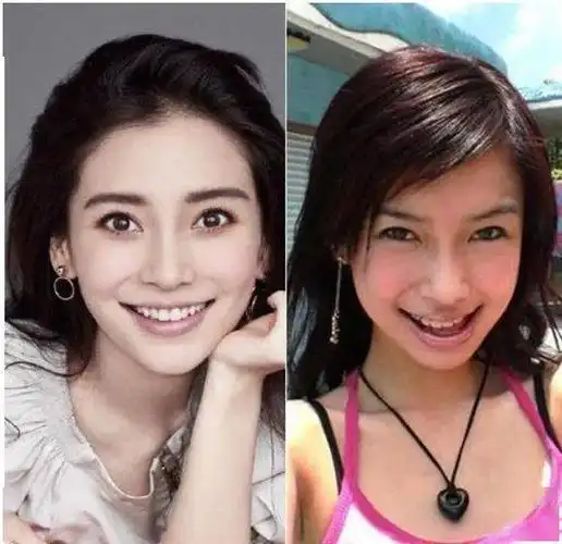 吴宣仪的牙还有救吗?_牙齿