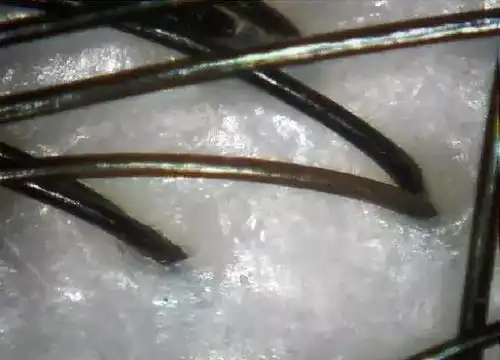 头发是没有ph值的,但头皮的ph值决定头发的干中油形态,其中油性为3-4.