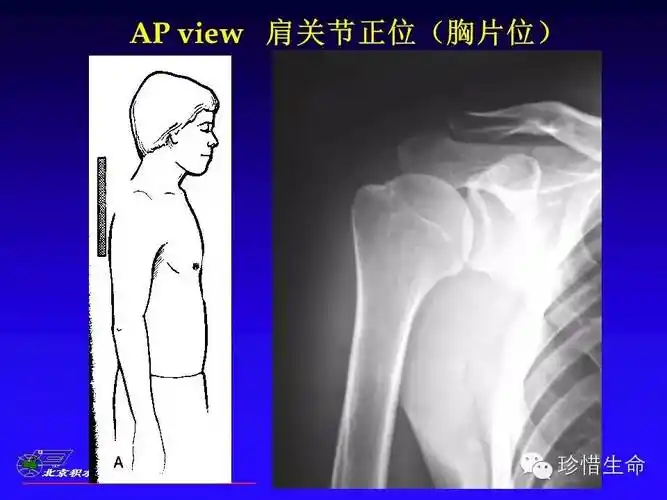 肩关节x线检查体位大全