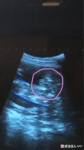 二胎确认男宝,俩儿子了