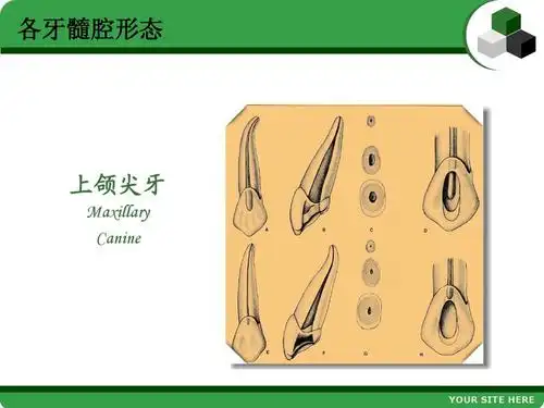 各牙髓腔形态 上颌尖牙 maxillary canine your site here