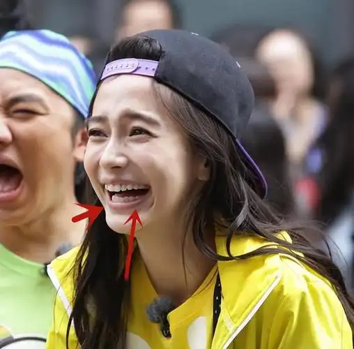 不过肯定是正过牙,牙齿确实对颜值影响很大,不过终归杨颖虽然演技不行