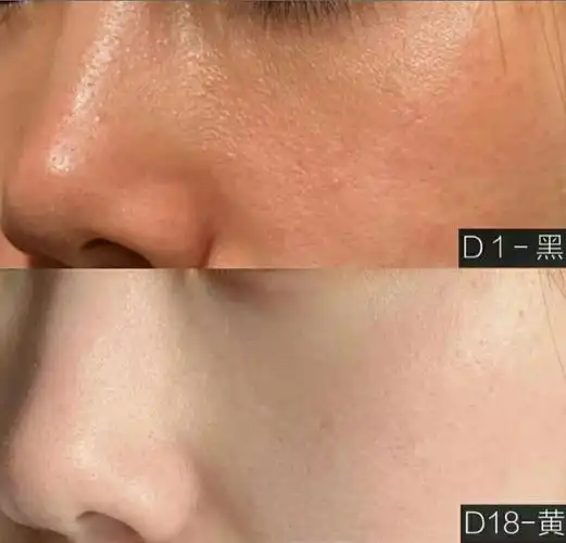 抱着试试的心态入手了一瓶,上脸还挺舒服的,水感质地,流动性好,几秒就