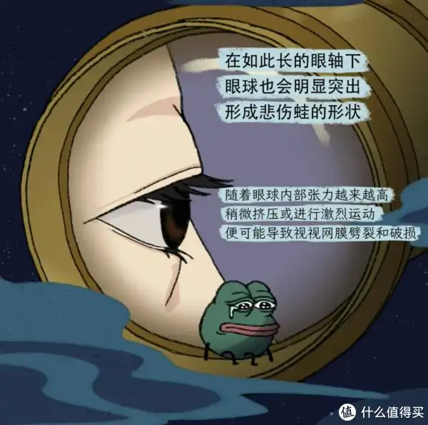 近视100度到10000度,眼睛是怎样一步步「裂开」的?