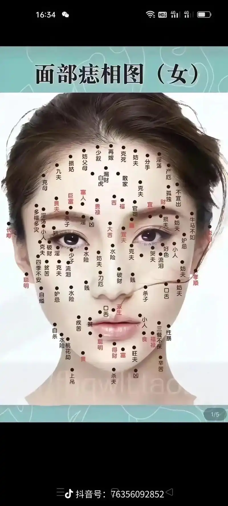 灿宝宝·3月前#国学文化#面相#识人术#智慧人生#你脸上的痣代表什么