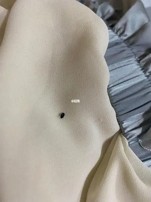 术后35天掉出来一个线头