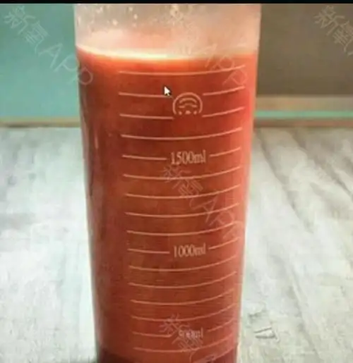 这是手术当天抽出来的多余的脂肪,看着我好恶心,以后_圈子-新氧美容