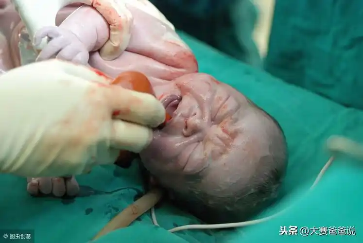 刚出生的宝宝怎么带婴儿的基本知识