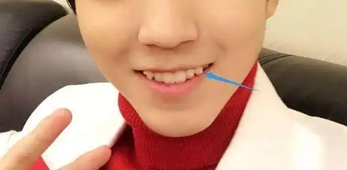 虎牙为什么不能轻易拔除?它有什么作用吗?