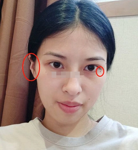 山根高加上反骨耳,说明你是个意志力坚定的女孩,性格比较反叛,主观有