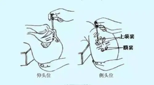 涨姿势!在为鼻子和耳朵给药时,这些环节真关键