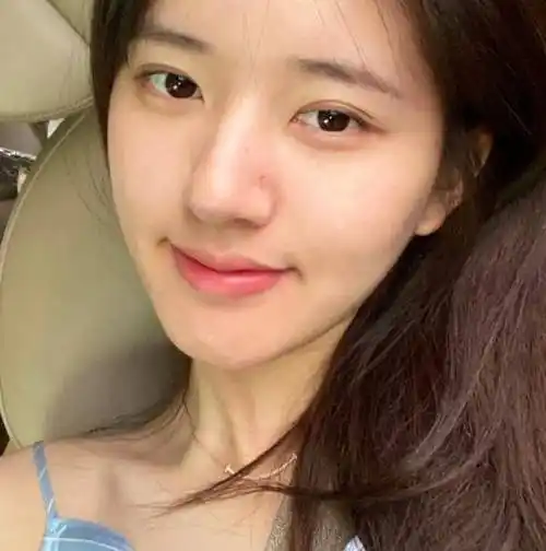 赵露思晒照,坐车上自拍"慵懒范"十足,22岁素颜皮肤状态绝了_照片_后续