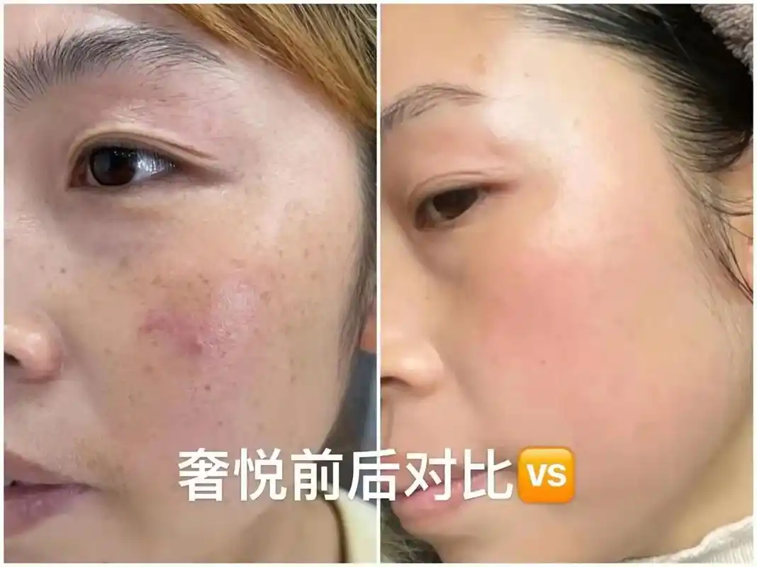 美白淡斑好皮肤养出来轻松拥有好皮肤女生最好看的样子不是18岁而是无