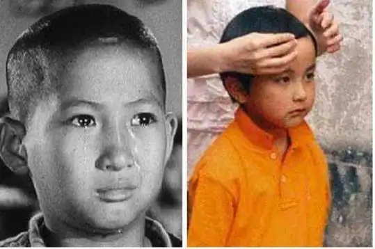 1985年,洪金宝和陈慧敏在尖沙咀决高下,临走时嘴上多了一道疤