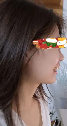 侧面看牙要飞出去了!