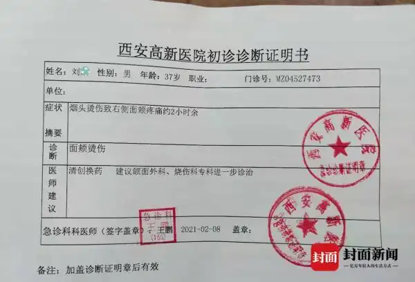 刘尧提供给封面新闻记者的西安高新医院的急诊病历显示,病人"烟头烫伤