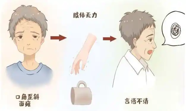 千万要小心!得了重症肌无力,这些症状会不断"提醒"你