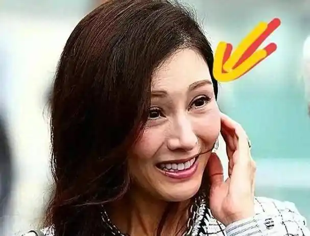 镜头下的李嘉欣,眼窝凹陷,法令纹明显,脸型松垮,笑容紧绷.