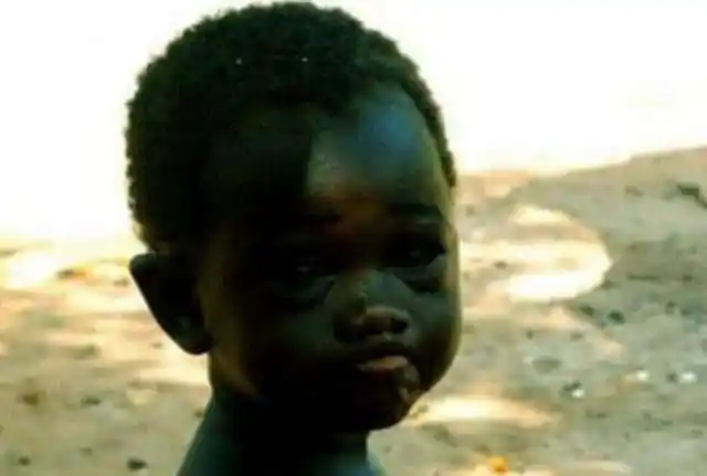 很多人因此猜想,可能是因为基因突变,才会导致这位黑人小孩的肤色变得