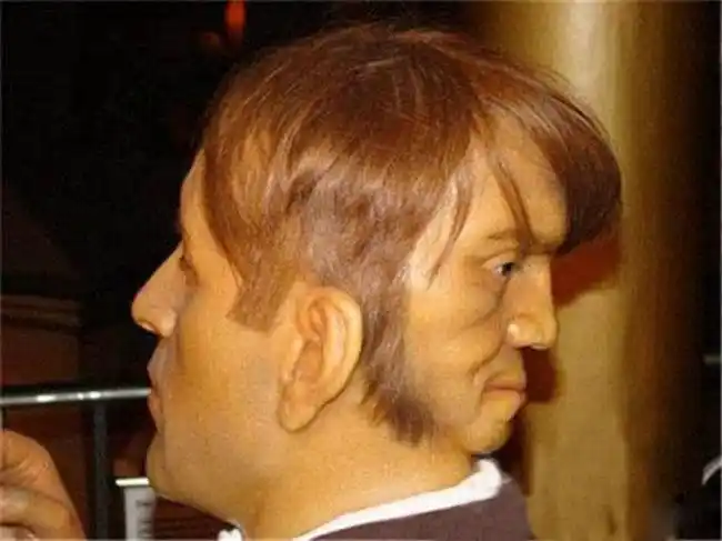 世界上仅有的双面人