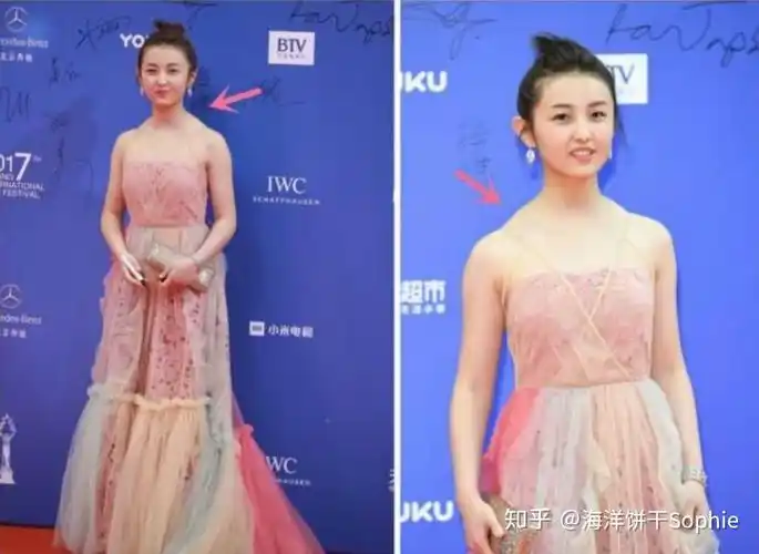 女生肩膀的上斜方肌太粗壮了怎么办?