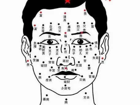 男人脸上有痣好不好图解