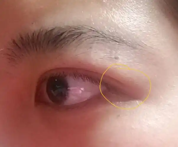 我这种肿双眼皮而且上眼皮很长且下压的眼睛怎么画