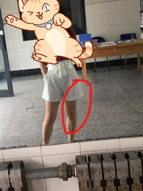 我的腿真是山路十八弯!怎么拯救