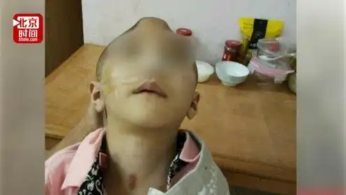 陕西"继母虐童案"宣判:继母被判处有期徒刑16年