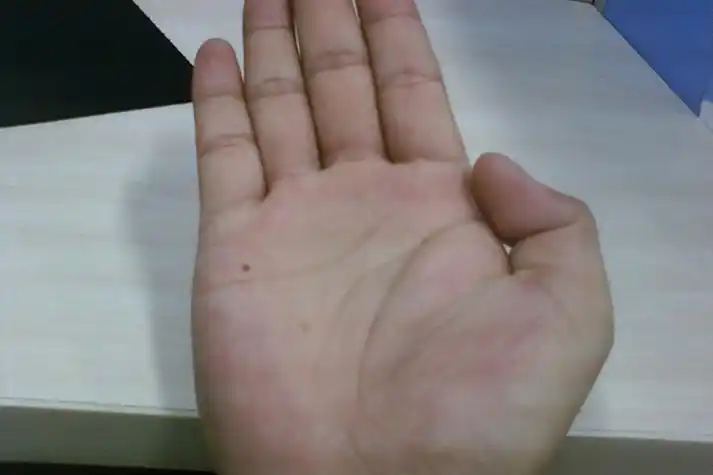 女人手掌有痣代表——上辈子约定这辈子结婚