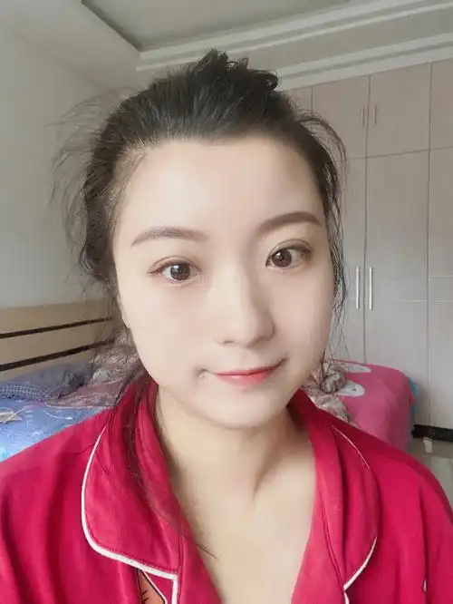 埋线双眼皮第九天