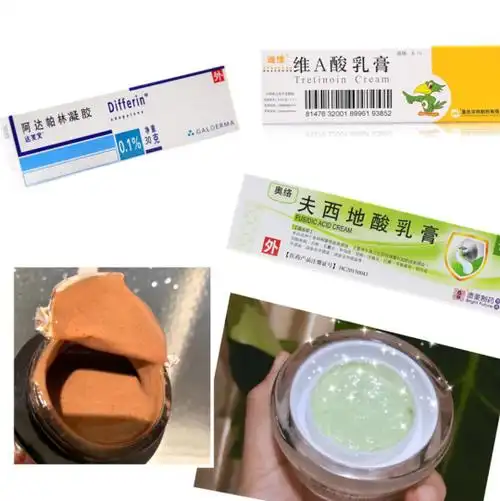 收缩毛孔的药膏