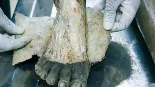 解剖实验室解剖解剖关于一c一d一ver展映背关于脚使用sc一照片