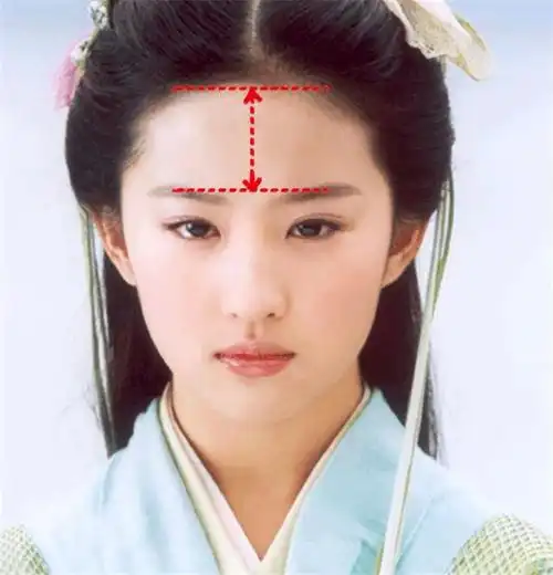 一个人的发际线太高,往往会引起自卑,就算五官精致,但如果有一个不