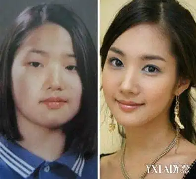 承认整容的韩国明星盘点这些前后对比照你们一定没见过