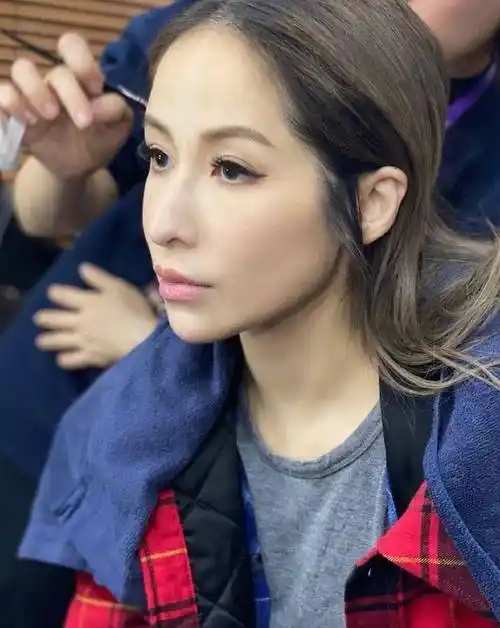 萧亚轩公开头部受伤照片,令人心疼!头部伤口超过5cm_明星_成龙_流量