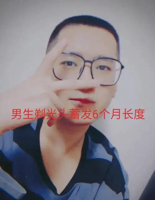 男生剃光头蓄发六个月长度