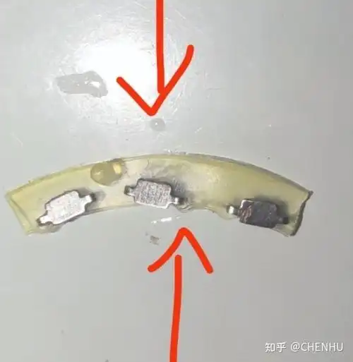 历时23天,终于结束了(包皮环切术脱钉技巧,超详) - 知乎