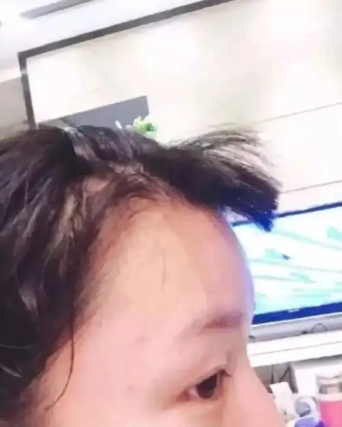 那些理发失败后哭笑不得的画面……|发型|刘海|平头|整容_网易订阅