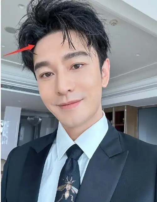 其实早在多年前,黄晓明就已经秃顶了,网上曾曝光后他头发稀疏的照片.