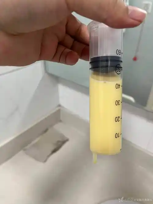 大佬们甲状腺良性肿物切除术后乳糜漏怎么处理呢