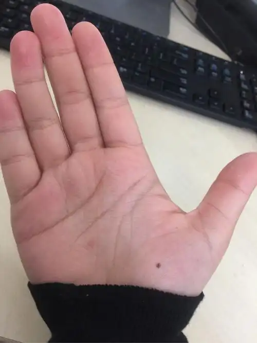 我的左手掌心有颗痣,突然很想找到右手掌心相同位置也有痣的人?