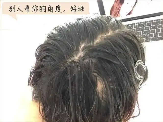 油性发质注意这一招挑战5天不洗头也不油清爽蓬松脸小到炸
