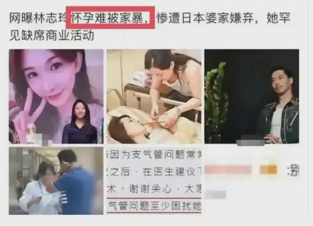 林志玲复出,曾被爆老公出轨三人,家暴她浑身是伤
