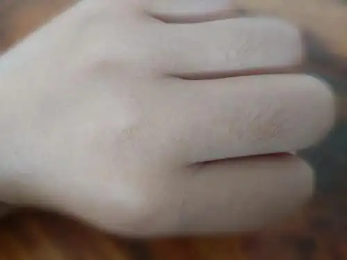 鹅们会有这种手毛吗